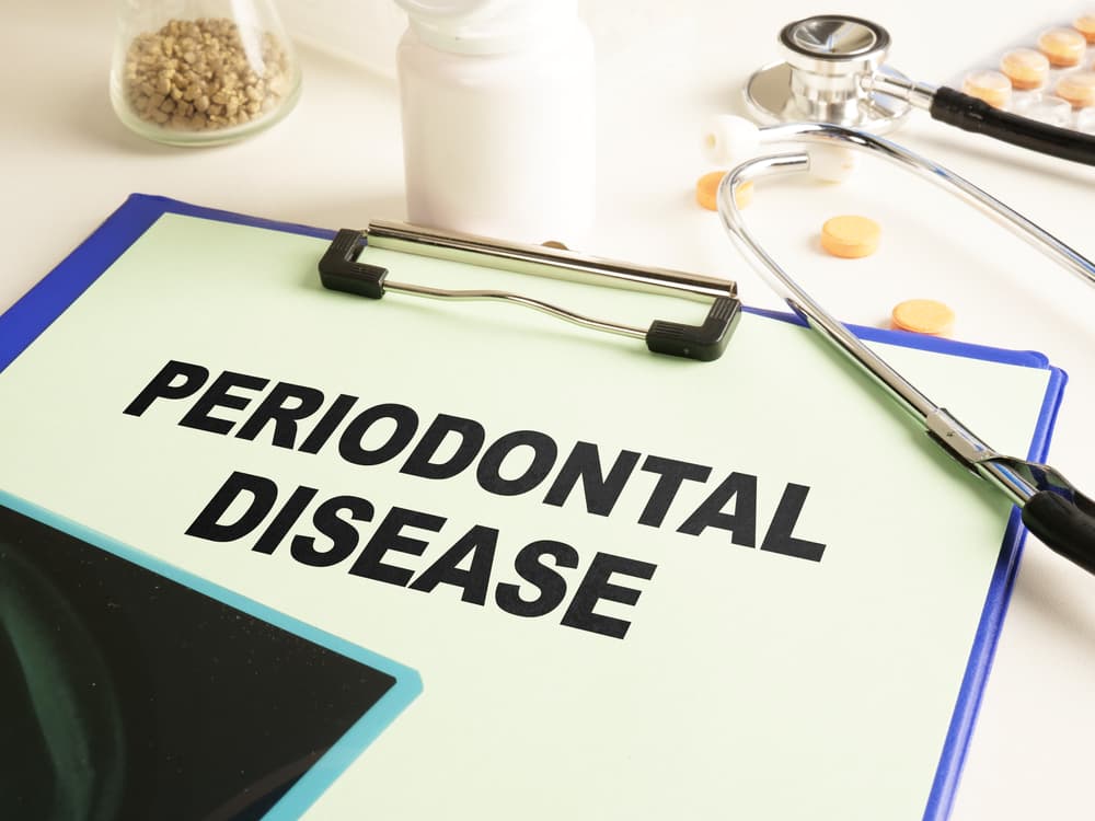 Periodontal Disease