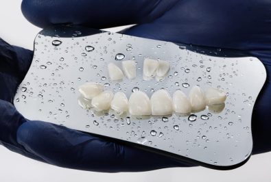 How to Take Care of Your Veneers – Terrace Dental Care