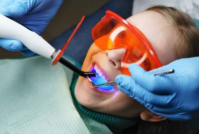 The Role of Sealants in Protecting Children’s Teeth