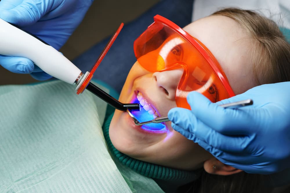 Sealants in Dawlish